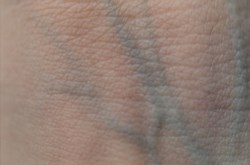 Veins